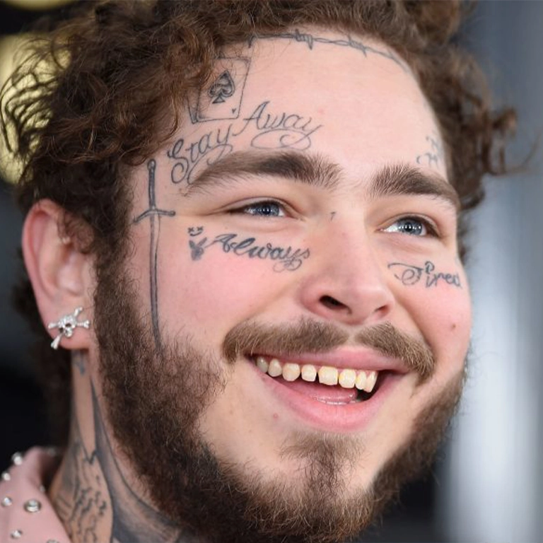 Post Malone after dental work